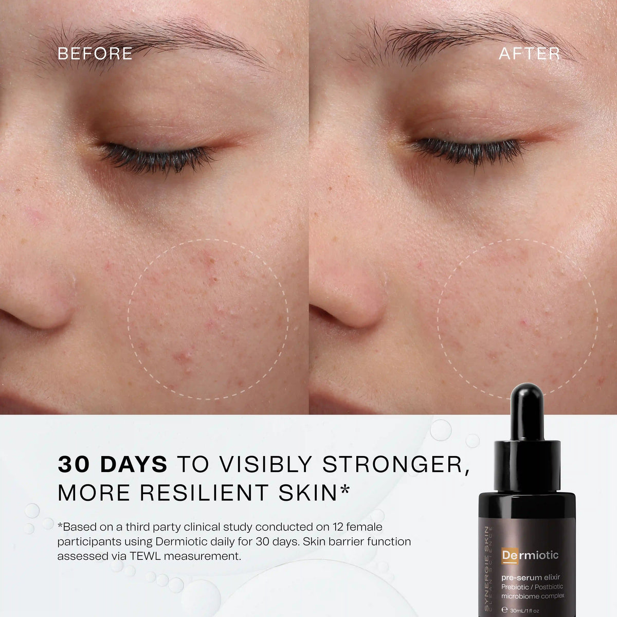 Synergie - Dermiotic (pre serum elixir)